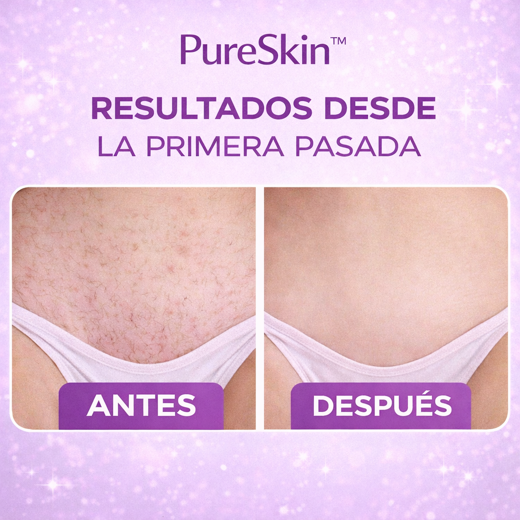 PureSkin™ Depiladora 2 en 1 – Adiós pelitos en zonas delicadas