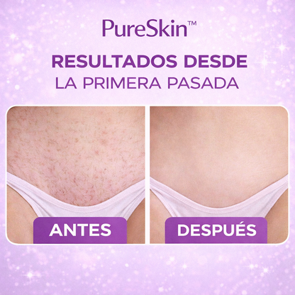 PureSkin™ Depiladora 2 en 1 – Adiós pelitos en zonas delicadas