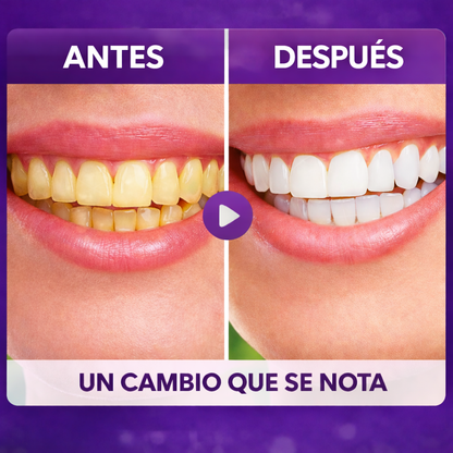PearlSmile™  5x1 – Adiós dientes amarillos al instante